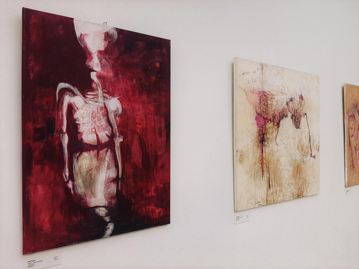 Anyaggá vált idő pt.1